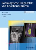 Radiologische Diagnostik von Knochentumoren (eBook, ePUB)