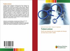 Tuberculose