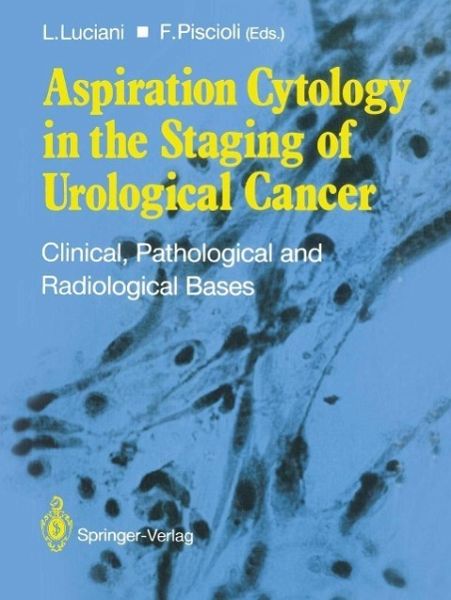 Aspiration Cytology in the Staging of Urological Cancer (eBook, PDF) Aspiration Cytology in the Staging of Urological Cancer (eBook, PDF)