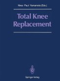 Total Knee Replacement (eBook, PDF)