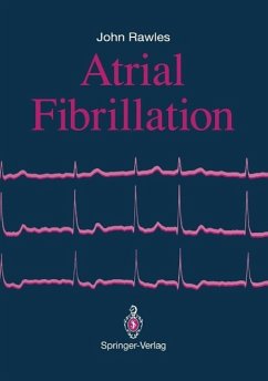 Atrial Fibrillation (eBook, PDF) - Rawles, John