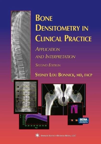 Bone Densitometry in Clinical Practice (eBook, PDF)