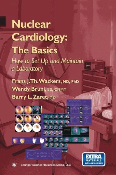 Nuclear Cardiology: The Basics (eBook, PDF) Nuclear Cardiology: The Basics (eBook, PDF)