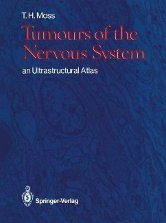 Tumours of the Nervous System (eBook, PDF) - Moss, Timothy H.