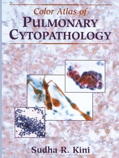 Color Atlas of Pulmonary Cytopathology (eBook, PDF) - Kini, Sudha R.