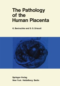 The Pathology of the Human Placenta (eBook, PDF) - Benirschke, Kurt