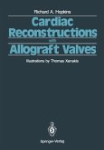 Cardiac Reconstructions with Allograft Valves (eBook, PDF)