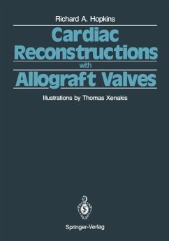 Cardiac Reconstructions with Allograft Valves (eBook, PDF) - Hopkins, Richard A.