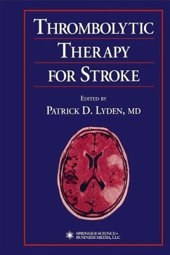 Cover Thrombolytic Therapy for Stroke (eBook, PDF)