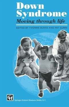Cover Down Syndrome (eBook, PDF)