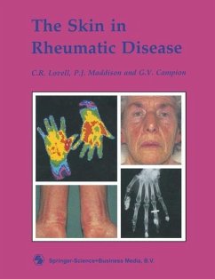 Cover The Skin in Rheumatic Disease (eBook, PDF)