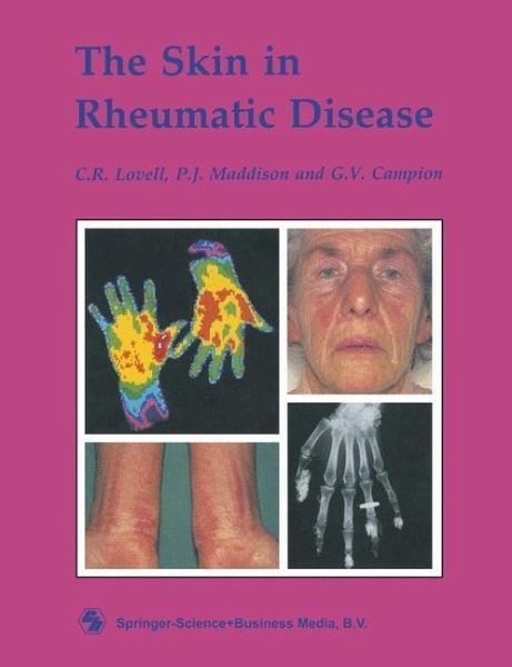 The Skin in Rheumatic Disease (eBook, PDF) The Skin in Rheumatic Disease (eBook, PDF)