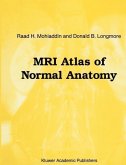 MRI Atlas of Normal Anatomy (eBook, PDF)