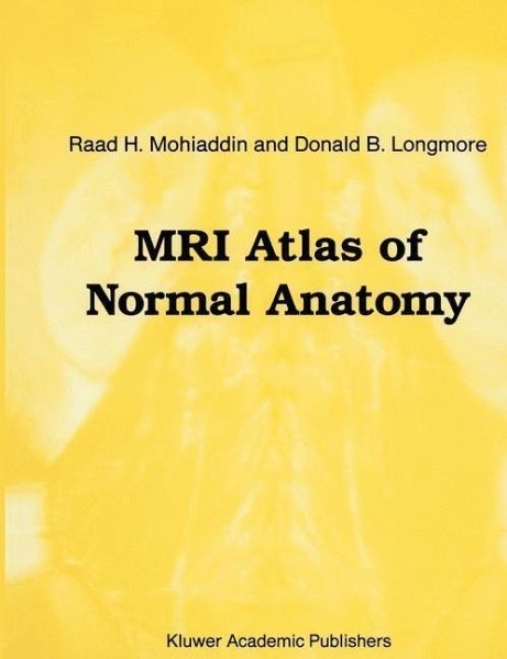 MRI Atlas of Normal Anatomy (eBook, PDF)