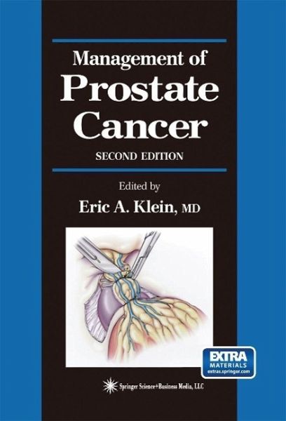Management of Prostate Cancer (eBook, PDF) Management of Prostate Cancer (eBook, PDF)