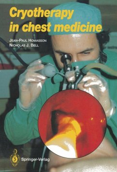 Cryotherapy in Chest Medicine (eBook, PDF) - Homasson, Jean-Paul