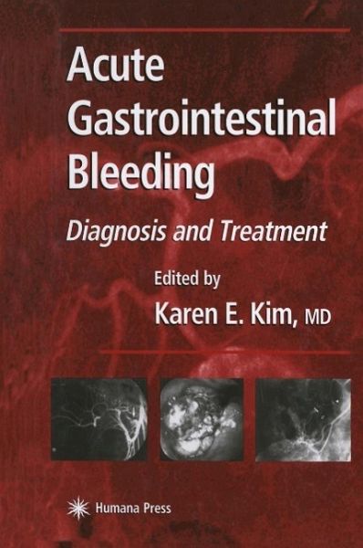 Acute Gastrointestinal Bleeding (eBook, PDF) Acute Gastrointestinal Bleeding (eBook, PDF)