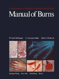 Manual of Burns (eBook, PDF) - McDougal, W. S.; Slade, C. L.; Pruitt, B. A. Jr.
