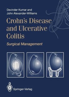 Crohn's Disease and Ulcerative Colitis (eBook, PDF) - Kumar, Devinder; Alexander-Williams, John