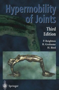Hypermobility of Joints (eBook, PDF) - Beighton, Peter; Grahame, Rodney; Bird, Howard