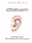 Otoplasty (eBook, PDF)