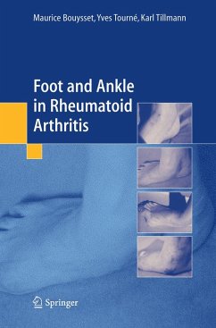 Foot and ankle in rheumatoid arthritis (eBook, PDF) - Bouysset, Maurice; Tourné, Yves; Tillmann, Karl