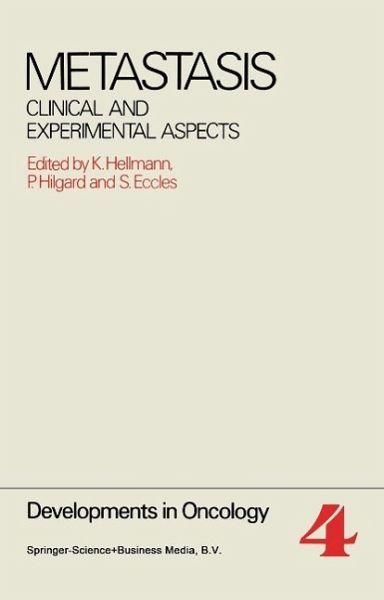 Metastasis (eBook, PDF) Metastasis (eBook, PDF)