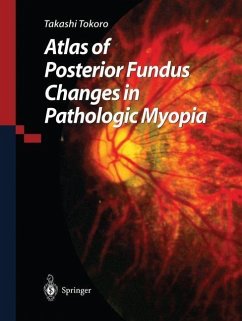 Atlas of Posterior Fundus Changes in Pathologic Myopia (eBook, PDF) - Tokoro, Takashi