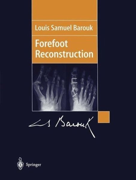 Forefoot Reconstruction (eBook, PDF) Forefoot Reconstruction (eBook, PDF)