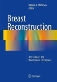 Breast Reconstruction (eBook, PDF)
