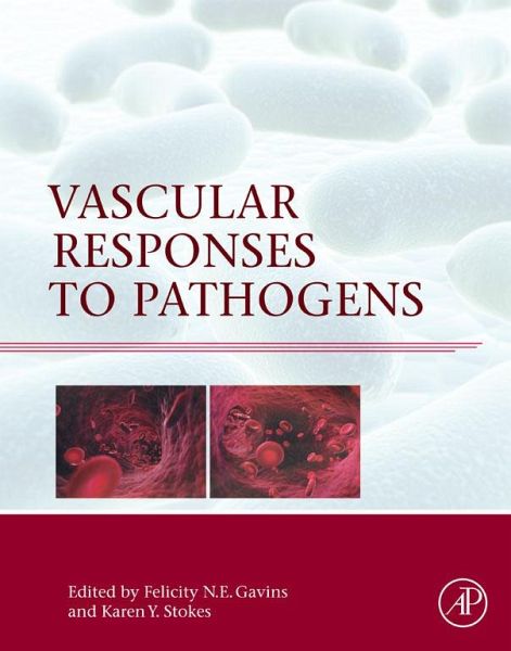 Vascular Responses to Pathogens (eBook, ePUB) Vascular Responses to Pathogens (eBook, ePUB)