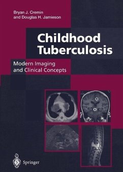 Childhood Tuberculosis: Modern Imaging and Clinical Concepts (eBook, PDF) - Cremin, Bryan J.; Jamieson, Douglas H.