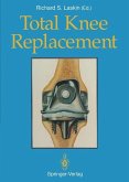 Total Knee Replacement (eBook, PDF)