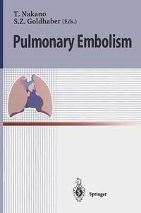 Pulmonary Embolism (eBook, PDF)