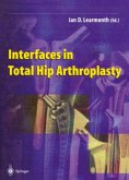 Interfaces in Total Hip Arthroplasty (eBook, PDF)