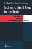 Ischemic Blood Flow in the Brain (eBook, PDF)