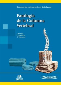 Patología de la columna vertebral - Sociedad Iberolatinoamericana de Columna