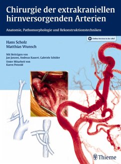 Chirurgie der extrakraniellen hirnversorgenden Arterien (eBook, PDF) - Scholz, Hans; Wunsch, Matthias