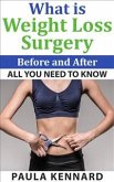 What Is Weight Loss Surgery: All You Need To Know Before And After (eBook, ePUB)