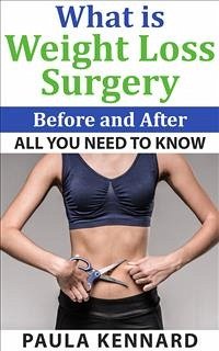 What Is Weight Loss Surgery: All You Need To Know Before And After (eBook, ePUB) - Kennard, Paula