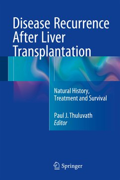 Disease Recurrence After Liver Transplantation (eBook, PDF)