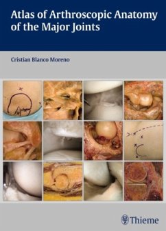 Atlas of Arthroscopic Anatomy of the Major Joints - Blanco Moreno, Cristian