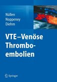 VTE - Venöse Thromboembolien (eBook, PDF)