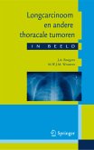 Longcarcinoom en andere thoracale tumoren in beeld (eBook, PDF)