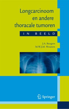 Longcarcinoom en andere thoracale tumoren in beeld (eBook, PDF) - Burgers, J. A.; Wouters, M.