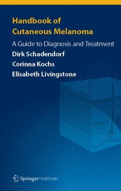 Handbook of Cutaneous Melanoma (eBook, PDF) - Schadendorf, Dirk; Kochs, Corinna; Livingstone, Elisabeth