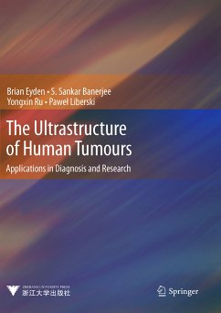 The Ultrastructure of Human Tumours (eBook, PDF) - Eyden, Brian; Banerjee, S. Sankar; Ru, Yongxin; Liberski, Pawel
