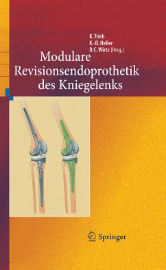 Revisionsendoprothetik des Kniegelenks (eBook, PDF)