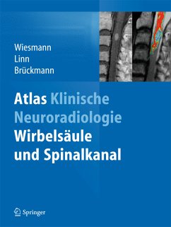 Atlas Klinische Neuroradiologie (eBook, PDF)