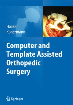 Computer and Template Assisted Orthopedic Surgery (eBook, PDF)